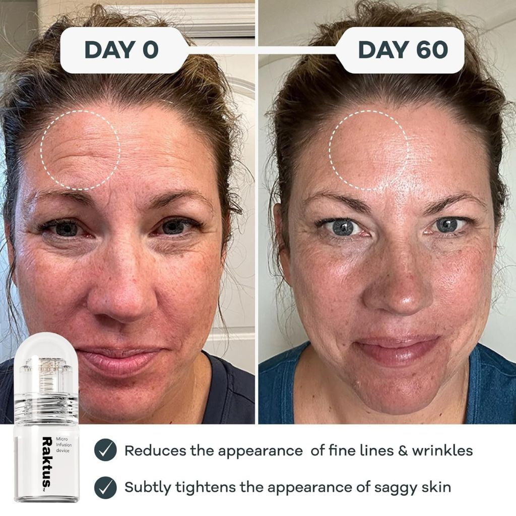 Smoother, Plumper-Looking Skin at Home — In 5 Minutes a Session